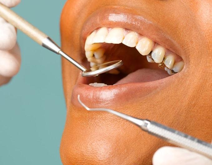 Diploma Dentist Needed - Bulenga Kasasa